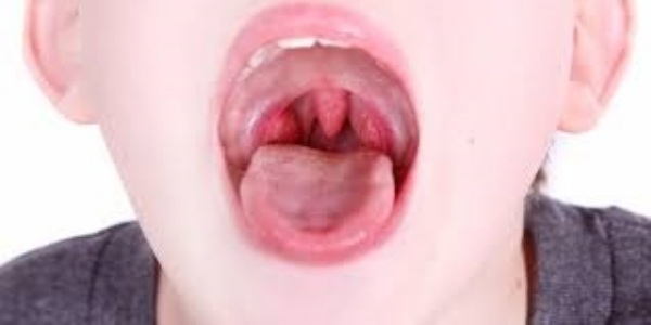 tonsil pain