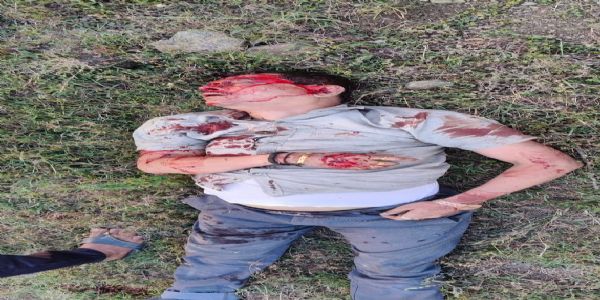 ಅಪಘಾತದಲ್ಲಿ ಹಿರಿಯ ಐಎಎಸ್ ಅಧಿಕಾರಿ ಮಹಾಂತೇಶ್ ಬೀಳಗಿ ಸಾವು