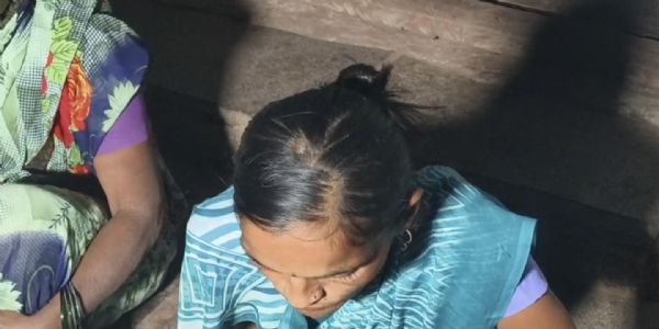 ಗಂಡು ಮಗುಗೆ ಜನ್ಮ ನೀಡಲು ಗೃಹಿಣಿಗೆ ಚಿತ್ರಹಿಂಸೆ ; ನೆತ್ತಿಯ ಕೂದಲು ತೆಗೆದು ಹಿಂಸೆ