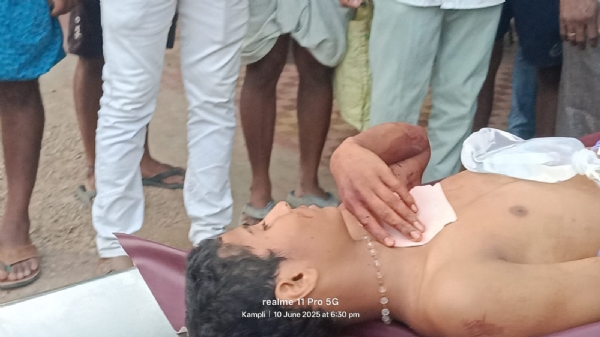 ಕಂಪ್ಲಿ: ಮೊಸಳೆ ದಾಳಿಗೆ ಗಾಯಗೊಂಡ ಬಾಲಕ