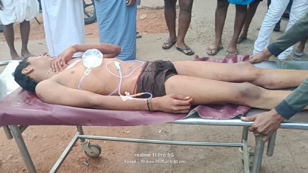 ಕಂಪ್ಲಿ: ಮೊಸಳೆ ದಾಳಿಗೆ ಗಾಯಗೊಂಡ ಬಾಲಕ