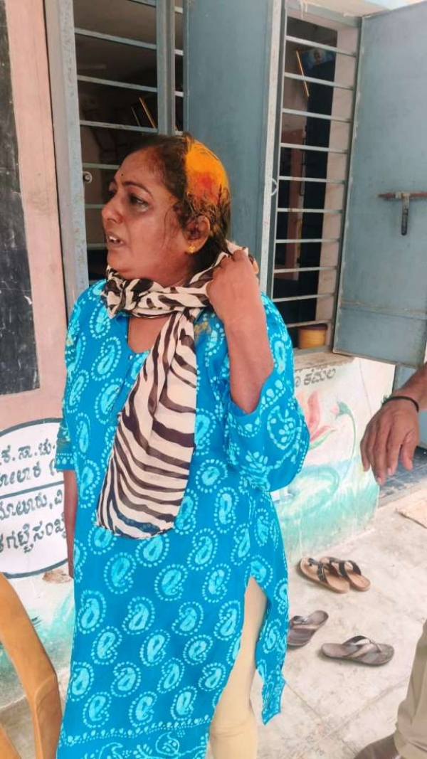 ಚಿತ್ರ : ಹಲ್ಲೆಗೆ ಒಳಗಾಗಿರುವ ಮಾಲುರು ತಾಲ್ಲೂಕಿನ ಟೇಕಲ್ನ ಕ್ಷೇತ್ರನಹಳ್ಳಿಯ ಸರ್ಕಾರಿ ಕಿರಿಯ ಪ್ರಾಥಮಿಕ ಶಾಲೆಯ ಶಿಕ್ಷಕಿ ಮಂಜುಳ. ಆತ್ಮಹತ್ಯೆ ಮಾಡಿಕೊಳ್ಳುವುದು ಅಪರಾಧವಾಗಿರುತ್ತದೆ.