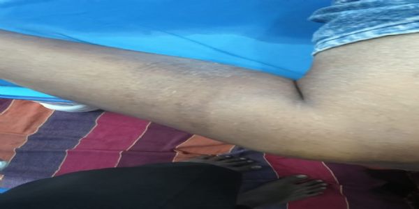 ವ್ಯಕ್ತಿಯ ಮೇಲೆ ಮಾರಣಾಂತಿಕ ಹಲ್ಲೆ