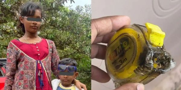 ವಿದ್ಯುತ್ ತಂತಿ ತಗುಲಿ ಇಬ್ಬರು ಮಕ್ಕಳಿಗೆ ಗಂಭೀರ ಗಾಯ: ಮನೆ ಮಾಲೀಕ, ಬೆಸ್ಕಾಂ ವಿರುದ್ಧ ದೂರು