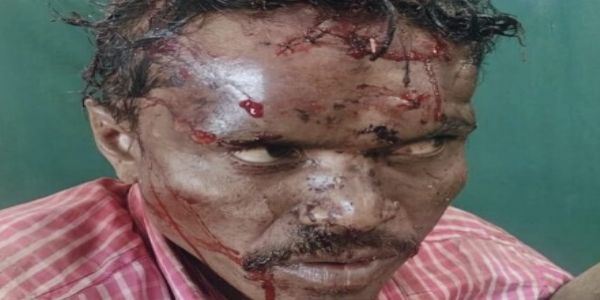 ಬಳ್ಳಾರಿ :ವ್ಯಕ್ತಿಗಳ ಮೇಲೆ ಹಲ್ಲೆ ನಡೆಸಿ ಮೊಬೈಲ್ - ಹಣ ದೋಚಿ ಪರಾರಿ
