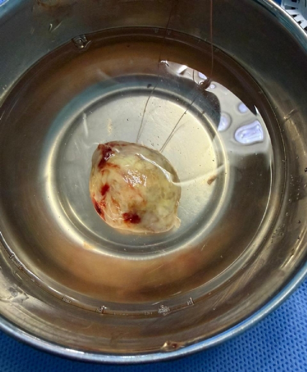 ಚಿಕಿತ್ಸೆ