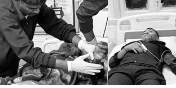 ಅಸ್ಸಾಂನಲ್ಲಿ ಪೊಲೀಸ್ ಕಮಾಂಡೋ ಶಿಬಿರದ ಮೇಲೆ ಗ್ರೆನೇಡ್ ದಾಳಿ: ನಾಲ್ವರಿಗೆ ಗಾಯ