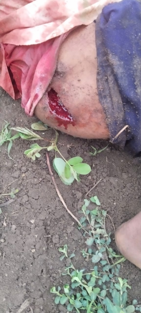 Wild Boar Attack in Bidar: Two Farmers Seriously Injured in Bhalki Taluk Wild Boar Attack in Bidar: Two Farmers Seriously Injured in Bhalki Taluk