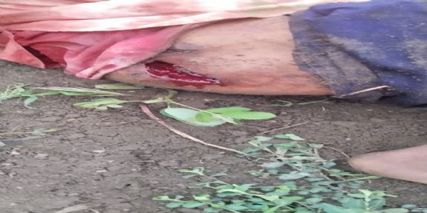 ಬೀದರ್: ಕಾಡು ಹಂದಿ ದಾಳಿಯಿಂದ ಇಬ್ಬರು ರೈತರಿಗೆ ಗಂಭೀರ ಗಾಯ